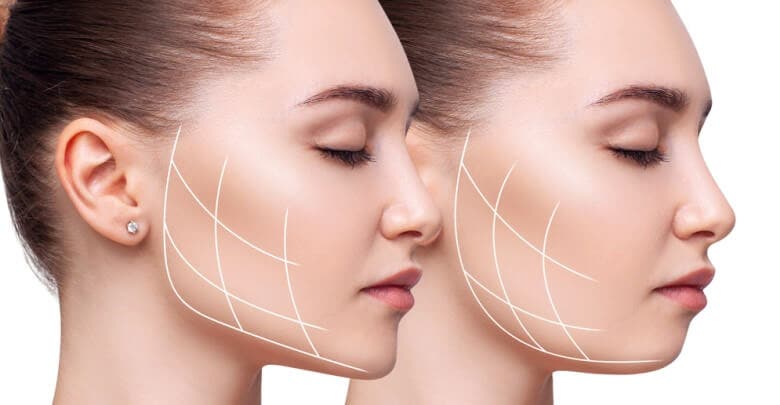 Jawline – nedir kimlere uygulanır