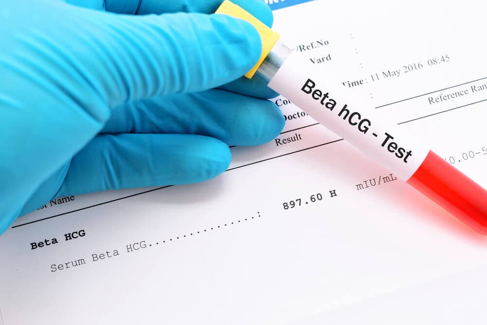 Beta HCG nedir, Beta HCG testi neden yapılır?