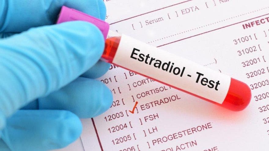 Estradiol testi nedir, yüksek ve düşük değerler ne anlama gelir?