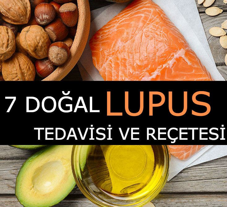 7 doğal lupus tedavisi ve reçetesi