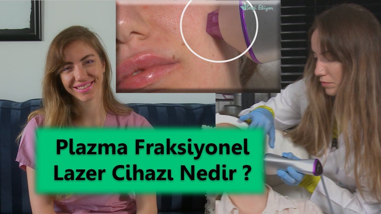 Plazma fraksiyonel lazer cihazı nedir? Avantajları nelerdir?